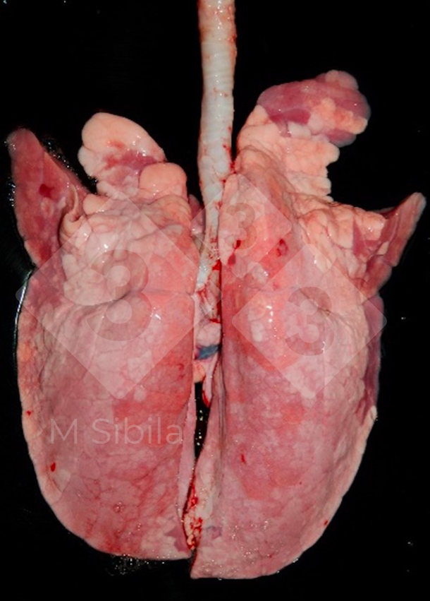 Lung 1