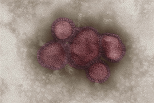 Influenza A virus – A_California_7_2009 (H1N1), colored, transmission  electron microscope (TEM).-1