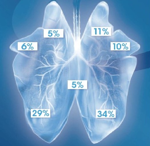 Schéma des poumons dun porc et des lobes pulmonaires