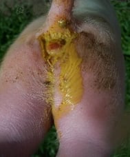 arrière train de porcelet souillé par de la diarrhée