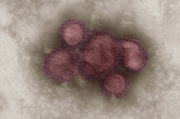 virus grippal porcin_microscopie électronique