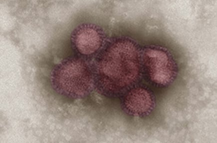 virus grippal porcin_microscopie électronique