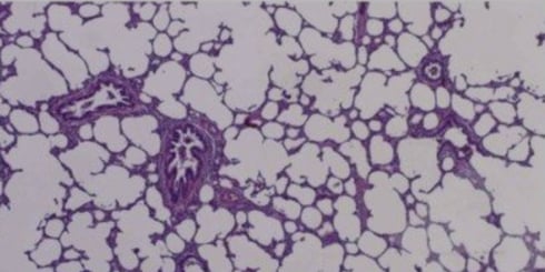histopatologia