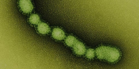 Impacto productivo y económico de la influenza porcina