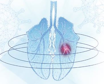 influenza complejo respiratorio multifactorial