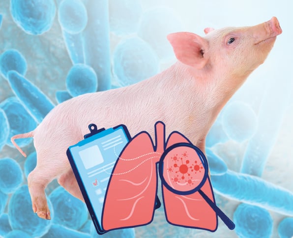 lesiones pulmonares gmd
