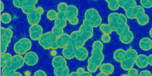 Aspectos claves de Actinobacillus pleuropneumoniae